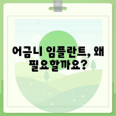 어금니 임플란트