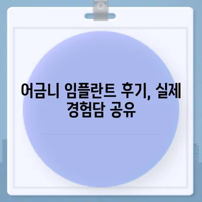 어금니 임플란트, 성공적인 치료를 위한 완벽 가이드 | 임플란트 종류, 비용, 주의사항, 후기